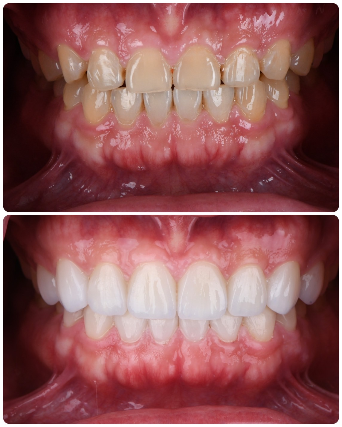 Before and After Case 8
